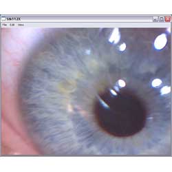 Untersuchung eines Auges mit dem USB-Mikropskop
