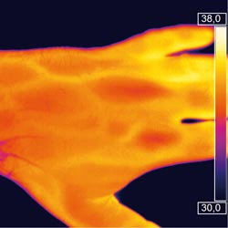 Durch die feinere Temperaturauflösung der Wärmebildkamera optris PI450 werden selbst Venen unter der Haut sichtbar.